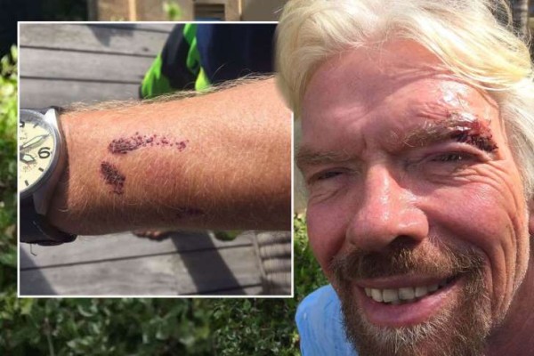 Richard Branson attacked by endangered shark family he campaigns to protect