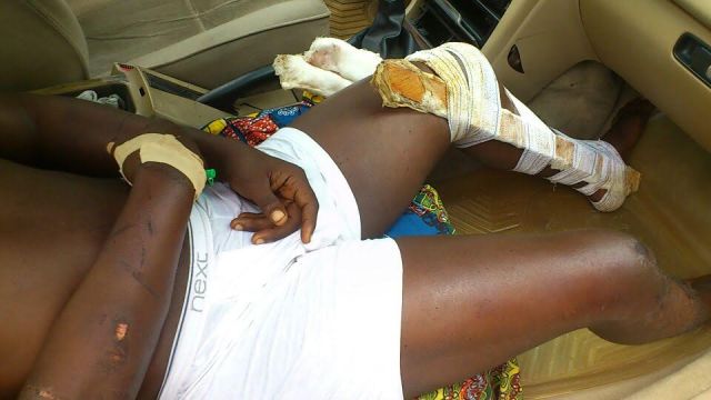 Victim of violence in Ekpan