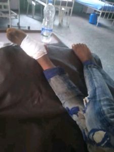 One of those injured in the explosion taking treatment. Photo: Allwell Anene