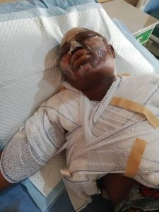 Comfort Ajayi: The fire accident victim