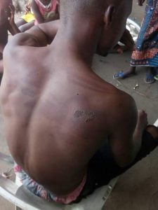 Nwanyanwu Promise with his lacerations allegedly inflicted on his body during alleged torture by members of OSAPC Vigilance group